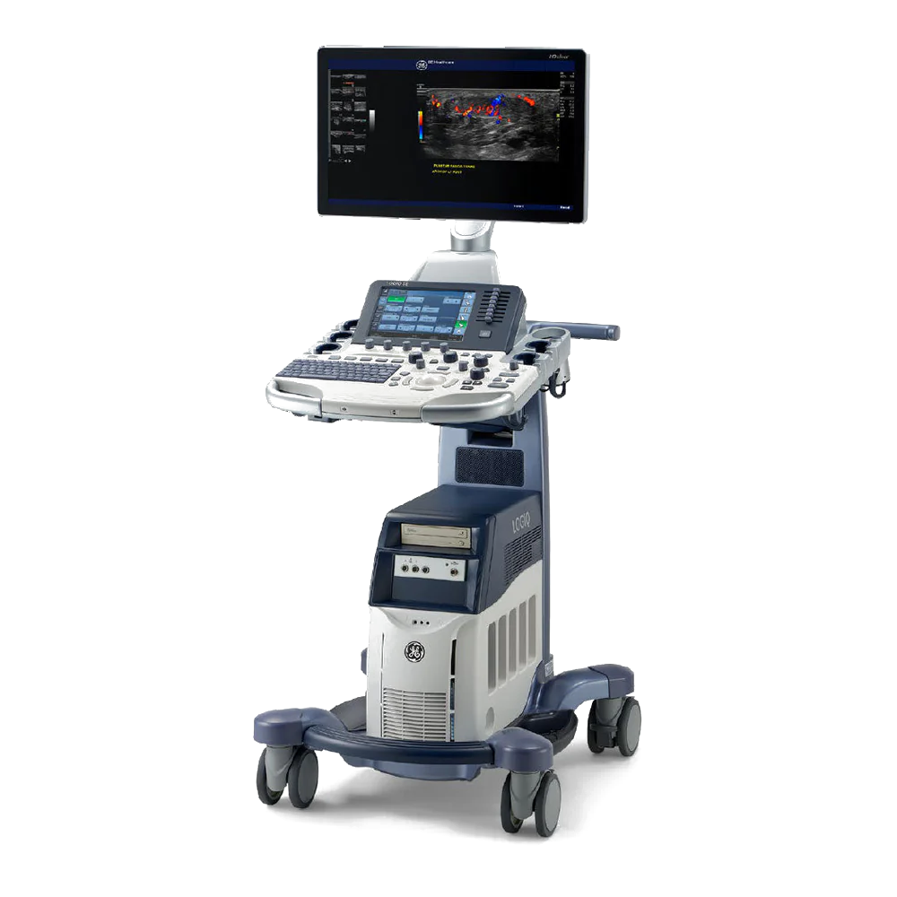 Ultrasound system on mobile cart